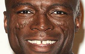 Seal singer facial scars Mature fucked with dildo